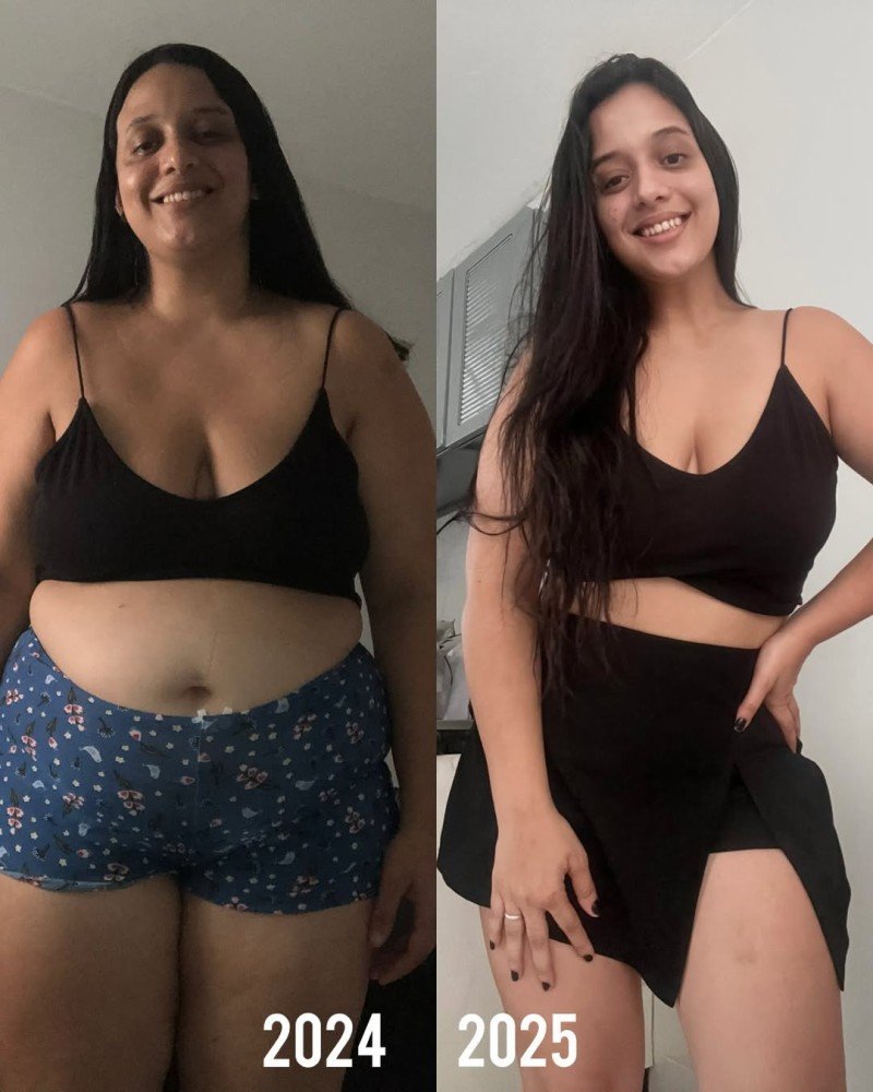 Antes do LIPO NATURAL